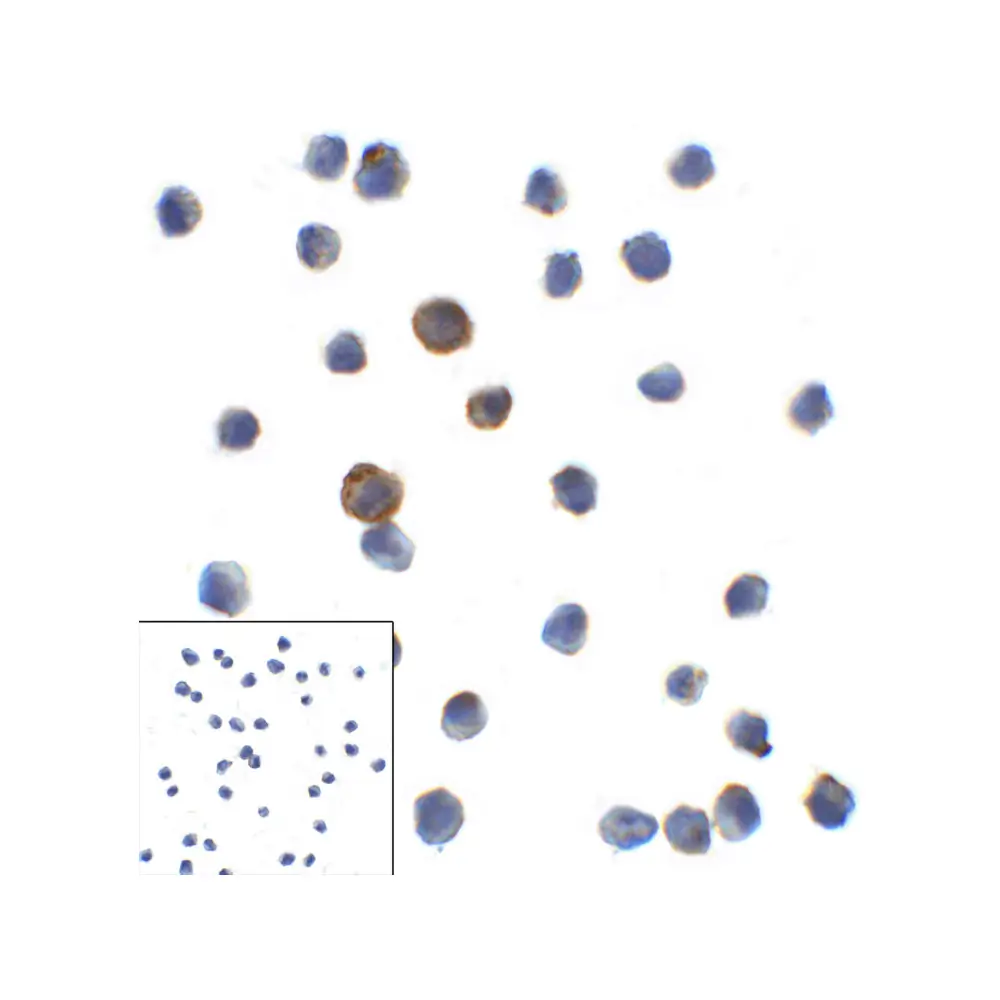 ProSci RF16084_S LAG3 Antibody [9F9], ProSci, 0.02 mg/Unit Primary Image