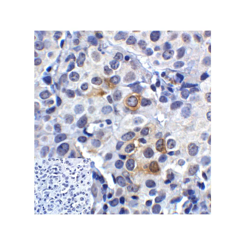 ProSci RF16084_S LAG3 Antibody [9F9], ProSci, 0.02 mg/Unit Quaternary Image