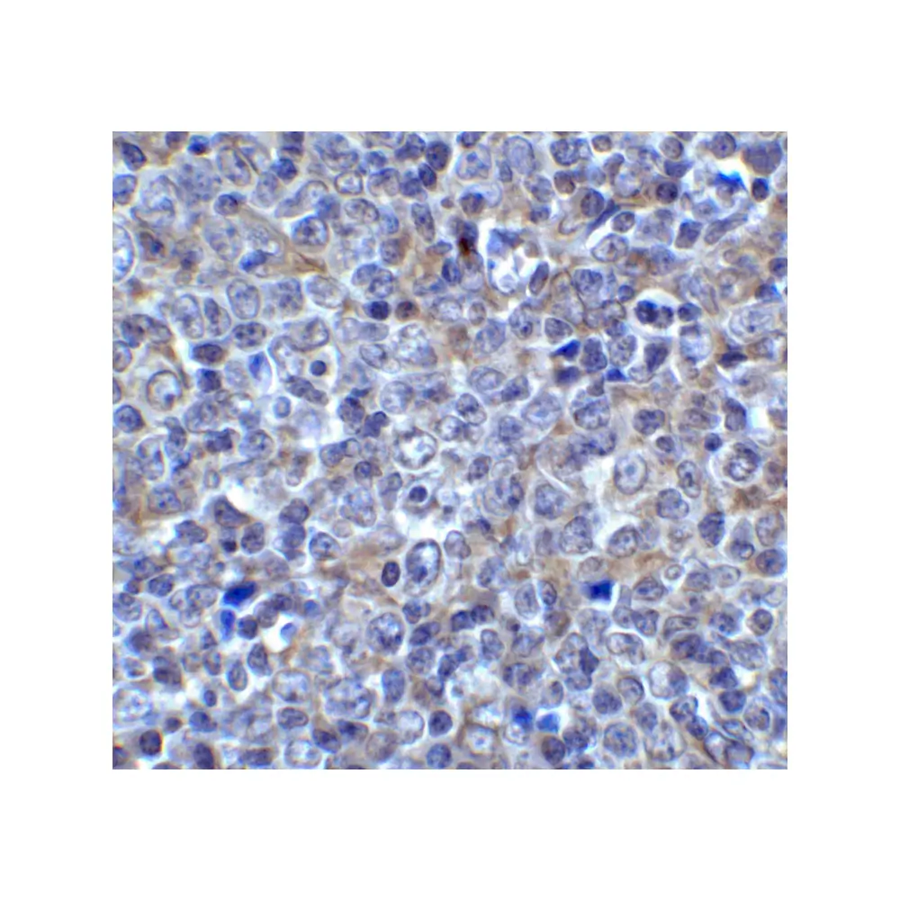 ProSci 8655 LAG3 Antibody, ProSci, 0.1 mg/Unit Secondary Image