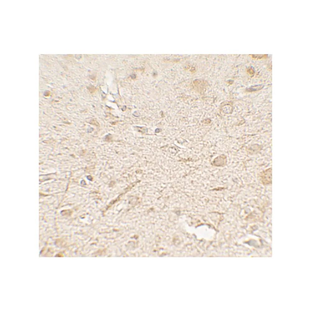 ProSci 7713 LAMTOR3 Antibody, ProSci, 0.1 mg/Unit Secondary Image