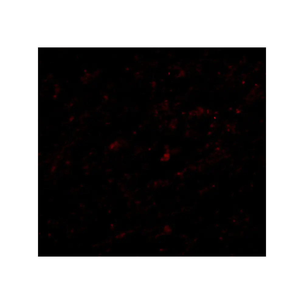 ProSci 4697_S LASS5 Antibody, ProSci, 0.02 mg/Unit Tertiary Image