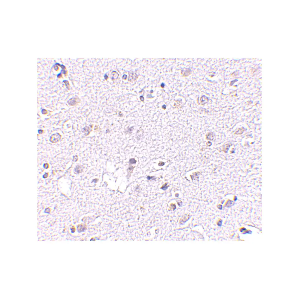 ProSci 4697_S LASS5 Antibody, ProSci, 0.02 mg/Unit Secondary Image