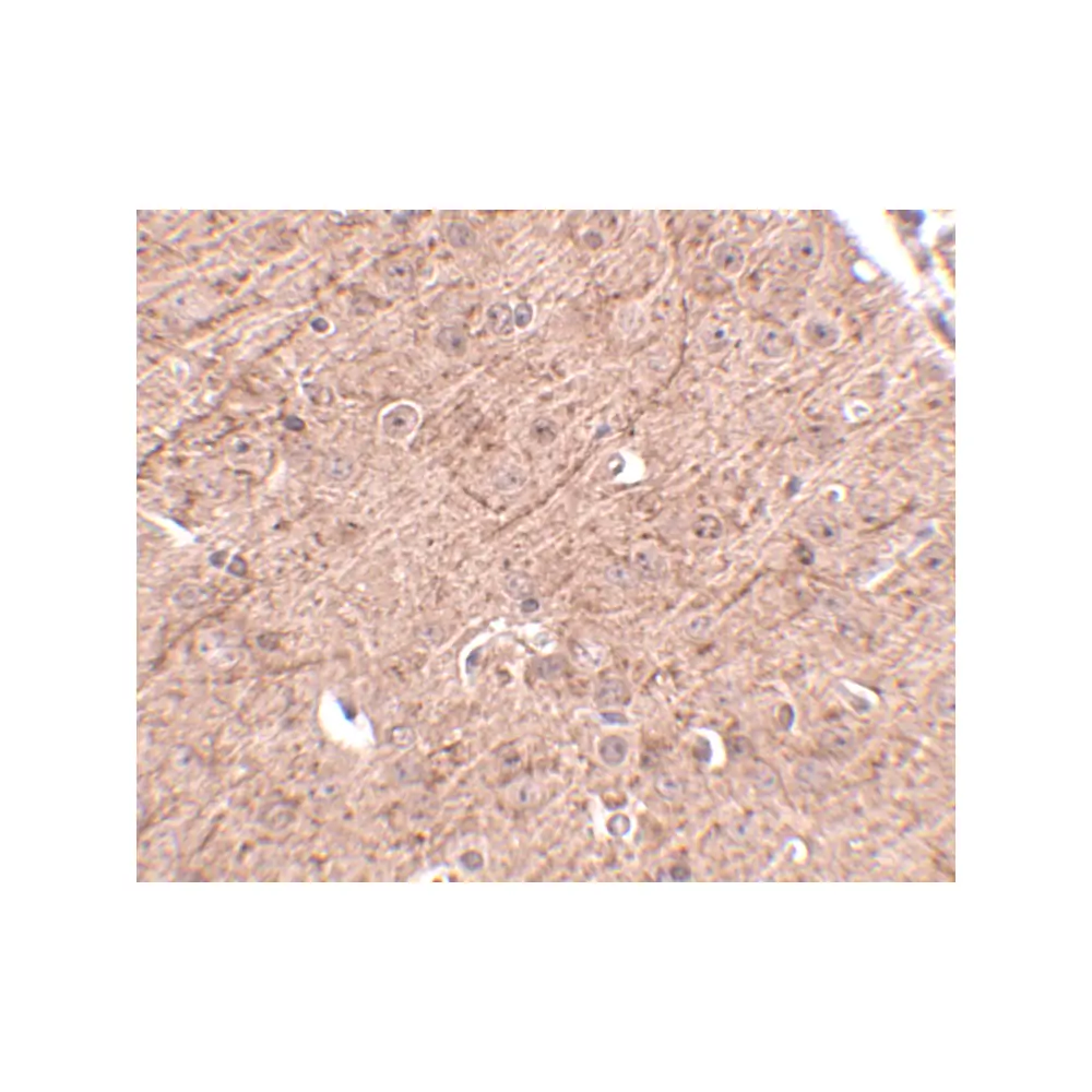 ProSci 4939_S LASS5 Antibody, ProSci, 0.02 mg/Unit Secondary Image