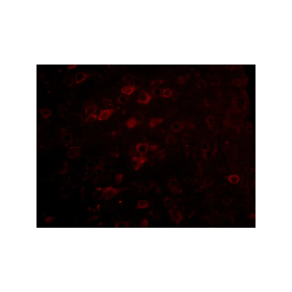 ProSci 4941_S LASS6 Antibody, ProSci, 0.02 mg/Unit Tertiary Image