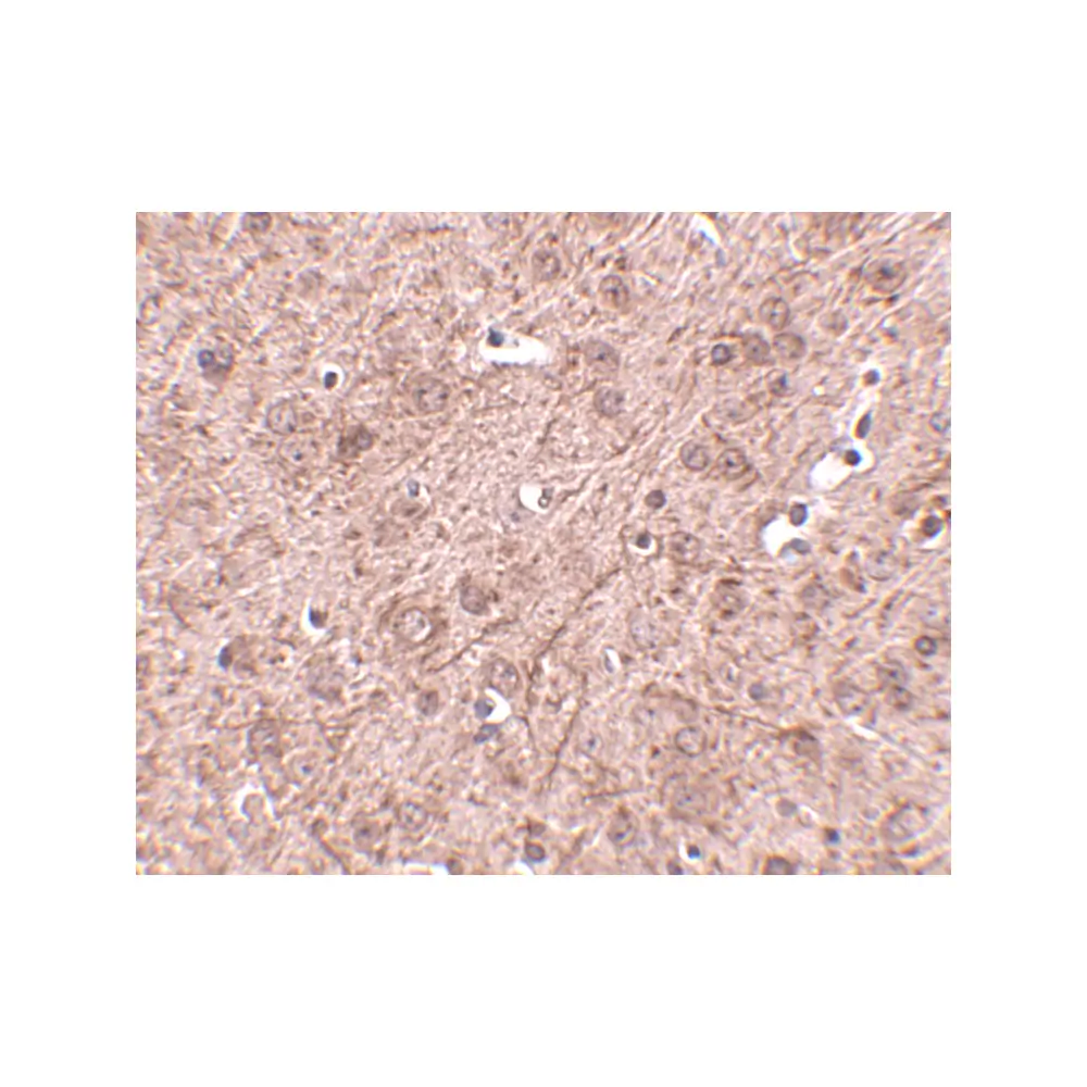 ProSci 4941 LASS6 Antibody, ProSci, 0.1 mg/Unit Secondary Image