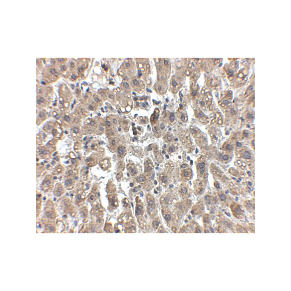 ProSci 5163 LDL-R Antibody, ProSci, 0.1 mg/Unit Secondary Image