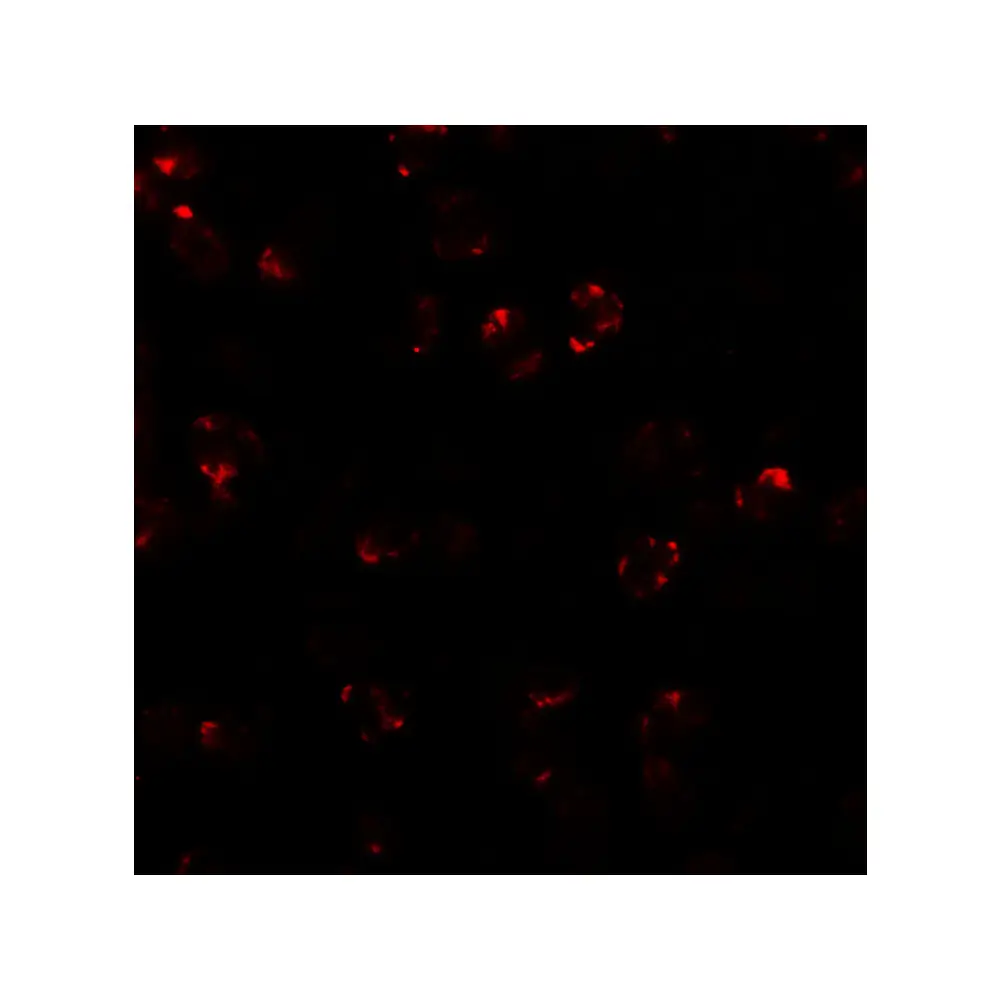 ProSci 6891 LEMD2 Antibody, ProSci, 0.1 mg/Unit Tertiary Image
