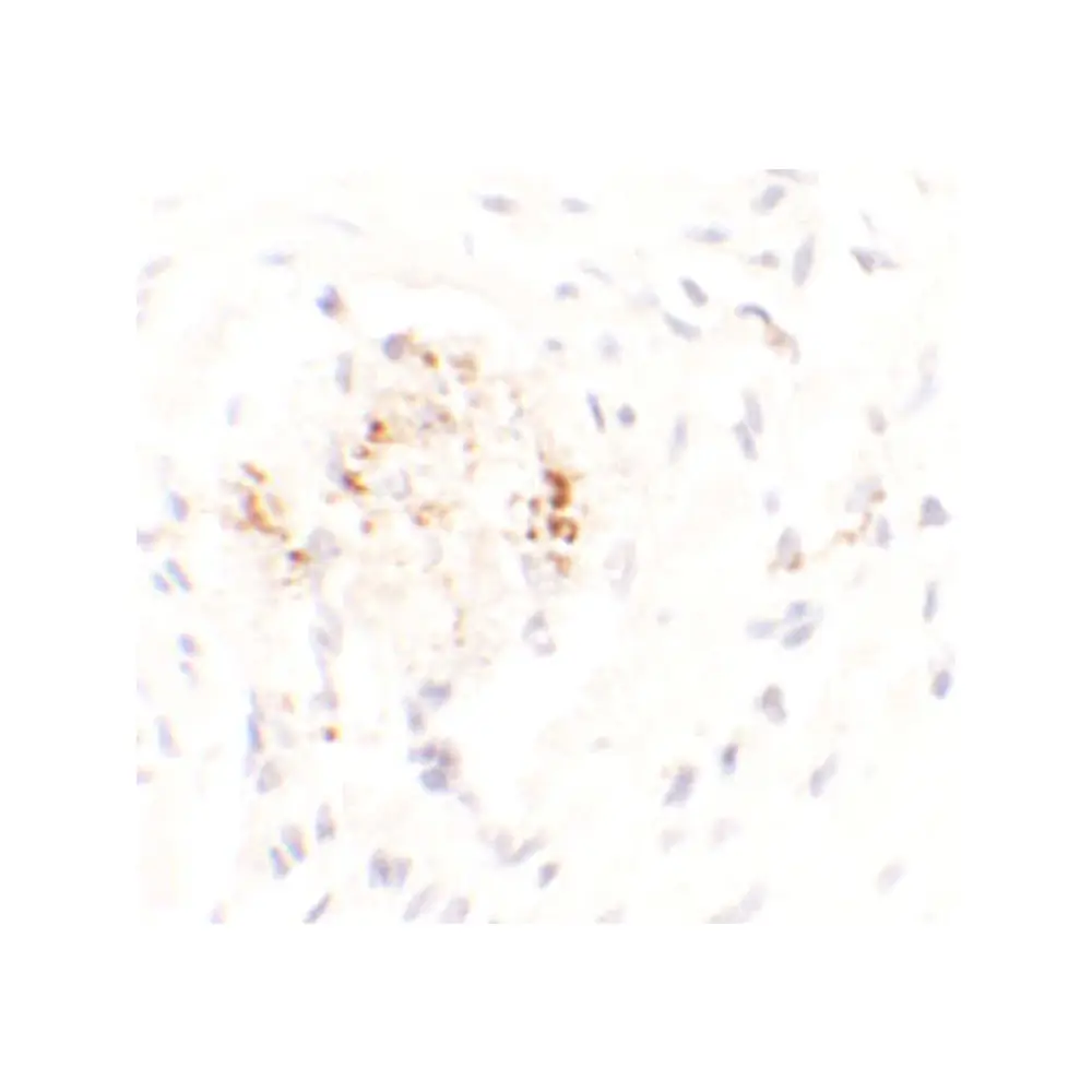 ProSci 6603 LEMD3 Antibody, ProSci, 0.1 mg/Unit Secondary Image
