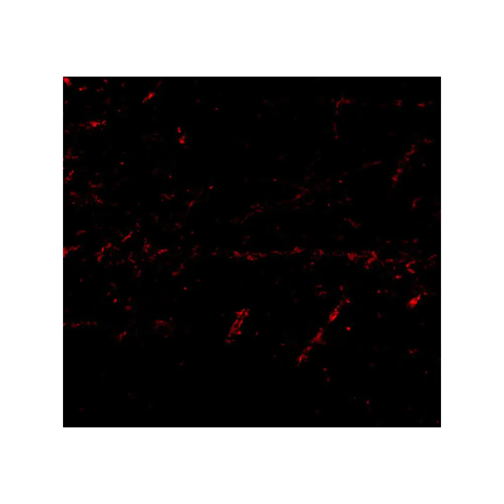 ProSci 4489 LGI1 Antibody, ProSci, 0.1 mg/Unit Tertiary Image