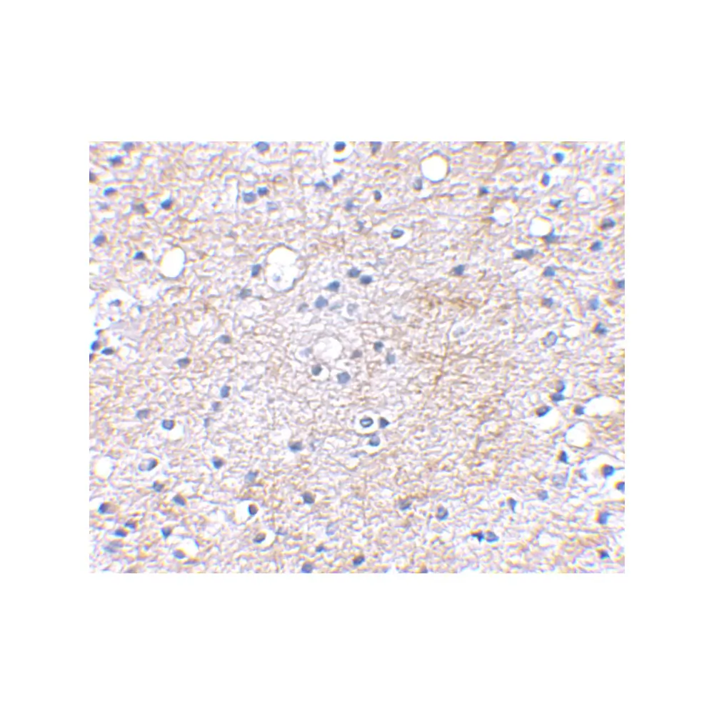 ProSci 4489_S LGI1 Antibody, ProSci, 0.02 mg/Unit Secondary Image