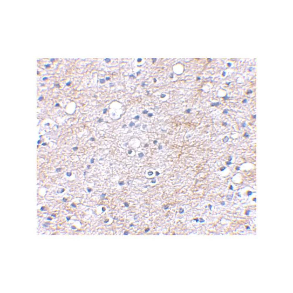 ProSci 4489 LGI1 Antibody, ProSci, 0.1 mg/Unit Secondary Image