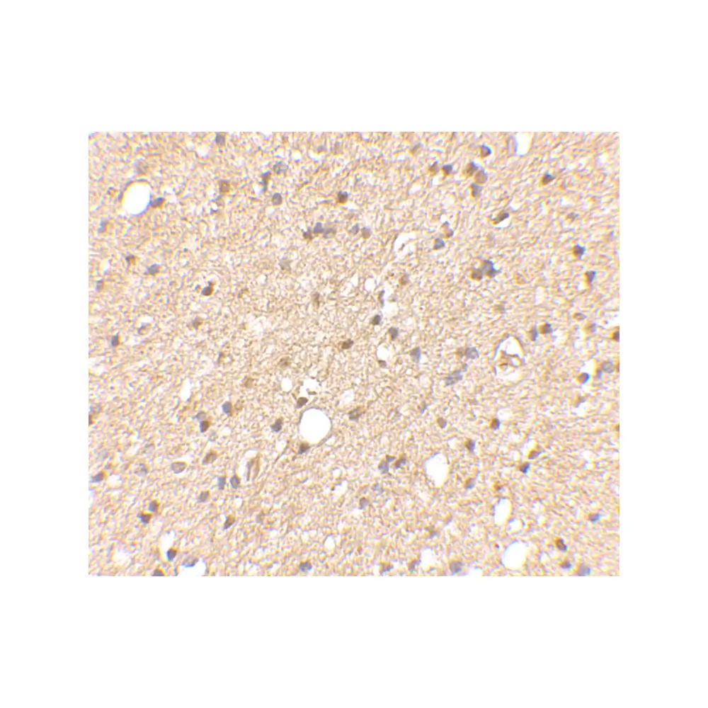 ProSci 4533_S LGI2 Antibody, ProSci, 0.02 mg/Unit Secondary Image