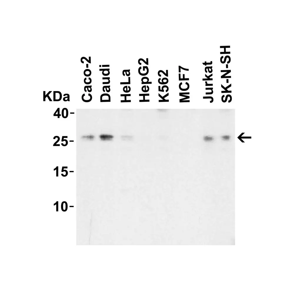ProSci 6245 LIF Antibody, ProSci, 0.1 mg/Unit Secondary Image