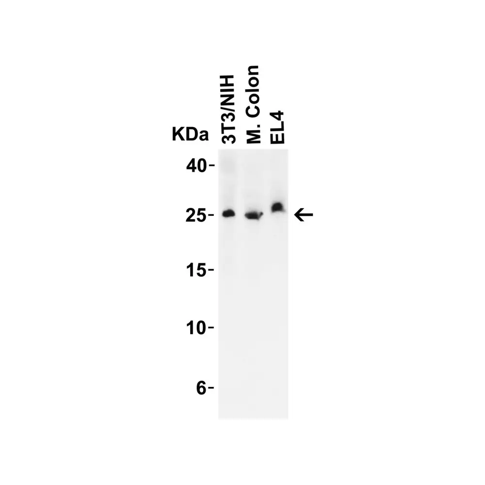 ProSci 6245_S LIF Antibody, ProSci, 0.02 mg/Unit Quaternary Image