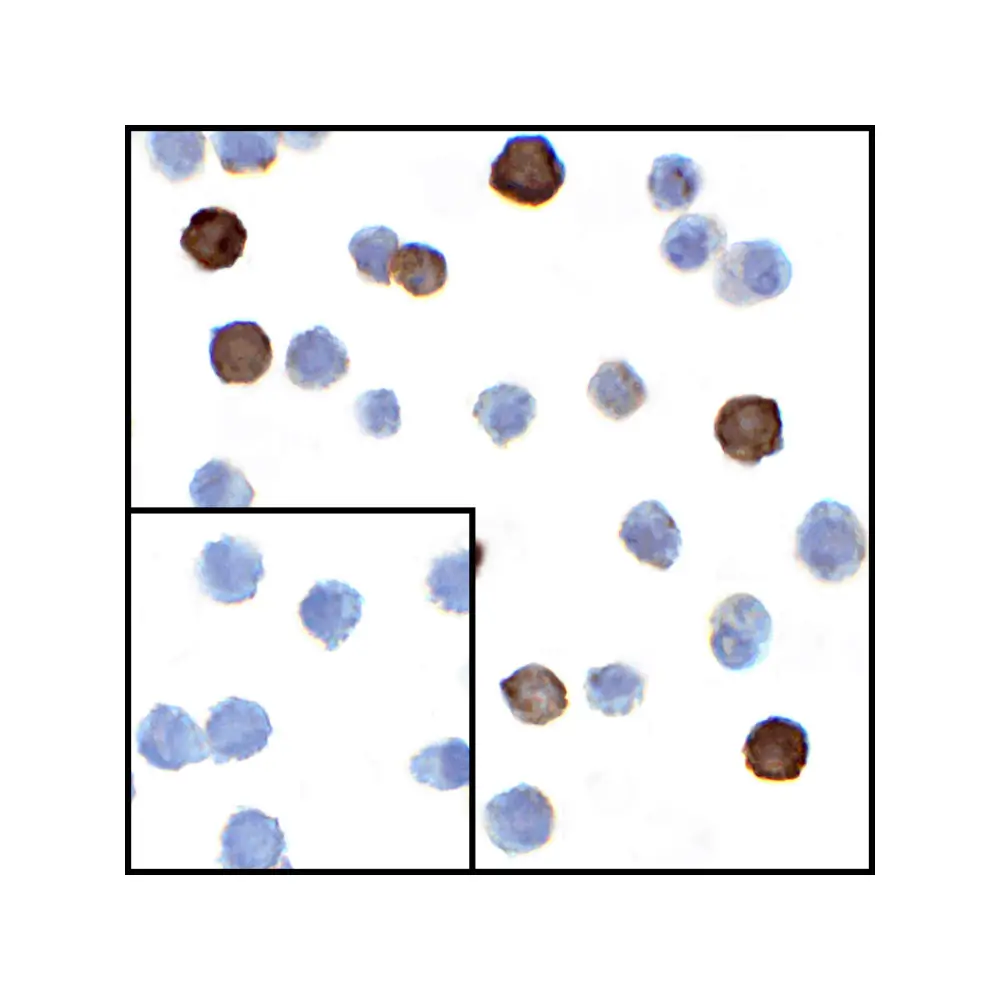 ProSci RF16063 LIGHT Antibody [7B9E12] , ProSci, 0.1 mg/Unit Secondary Image