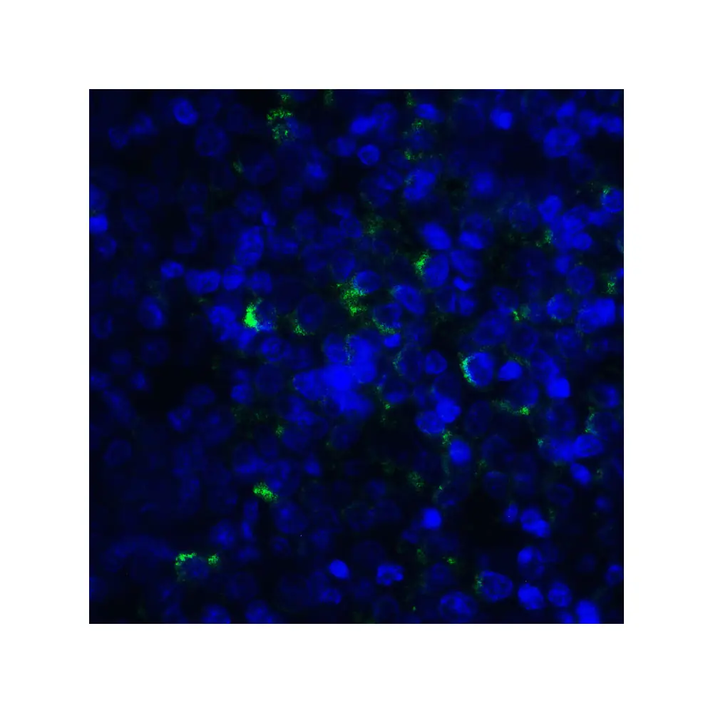 ProSci RF16063 LIGHT Antibody [7B9E12] , ProSci, 0.1 mg/Unit Quaternary Image
