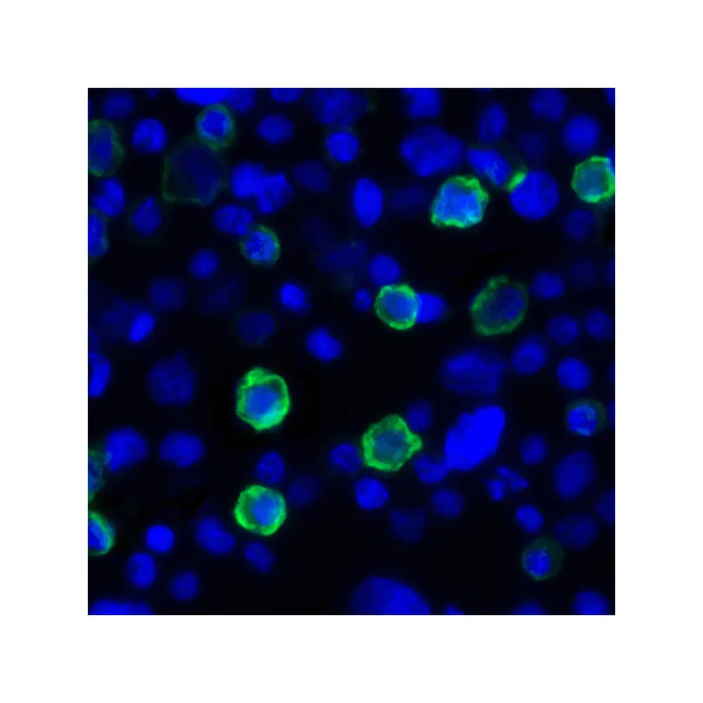 ProSci RF16063 LIGHT Antibody [7B9E12] , ProSci, 0.1 mg/Unit Tertiary Image