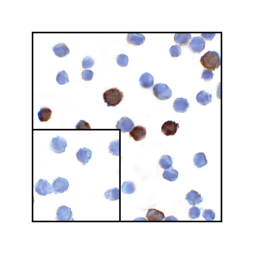 ProSci RF16061 LIGHT Antibody [7B9F12], ProSci, 0.1 mg/Unit Secondary Image