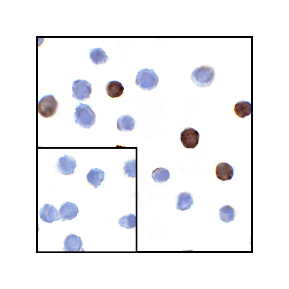 ProSci RF16064 LIGHT Antibody [8D4], ProSci, 0.1 mg/Unit Secondary Image