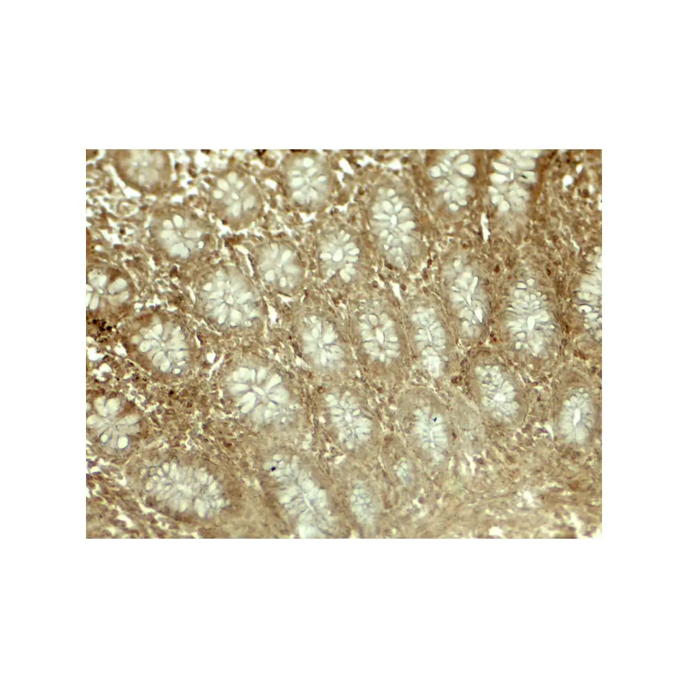ProSci 8053 LIMA1 Antibody, ProSci, 0.1 mg/Unit Secondary Image
