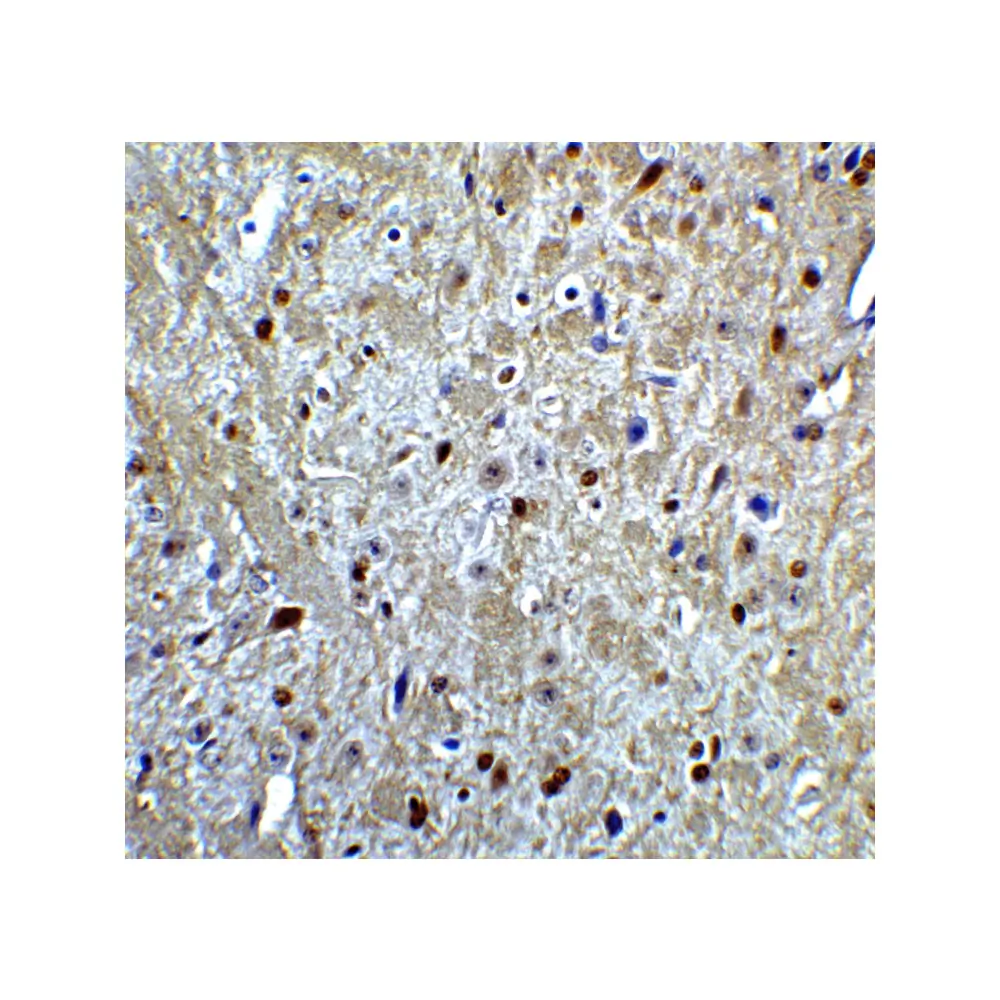 ProSci 7087_S LMX1A Antibody, ProSci, 0.02 mg/Unit Quaternary Image