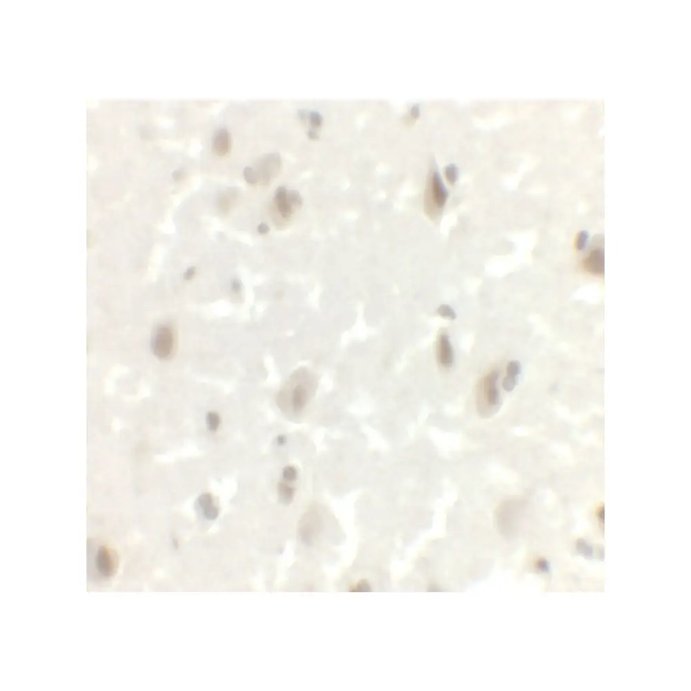 ProSci 7087_S LMX1A Antibody, ProSci, 0.02 mg/Unit Secondary Image