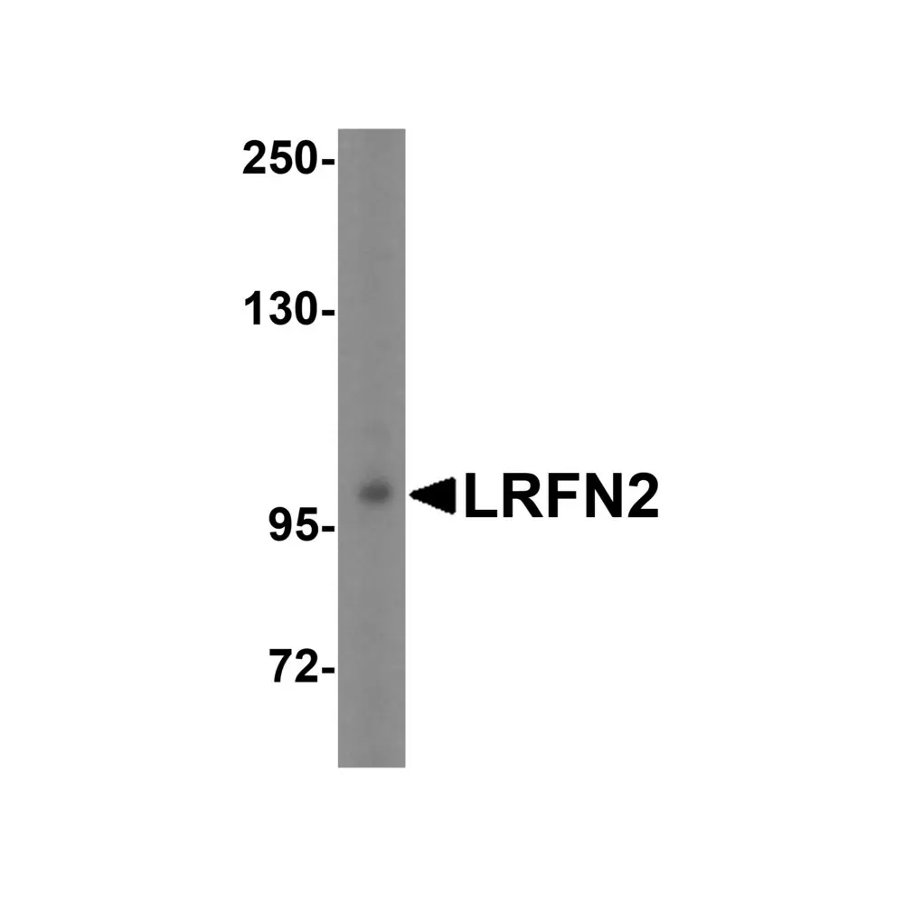 ProSci 5067 LRFN2 Antibody, ProSci, 0.1 mg/Unit Quaternary Image