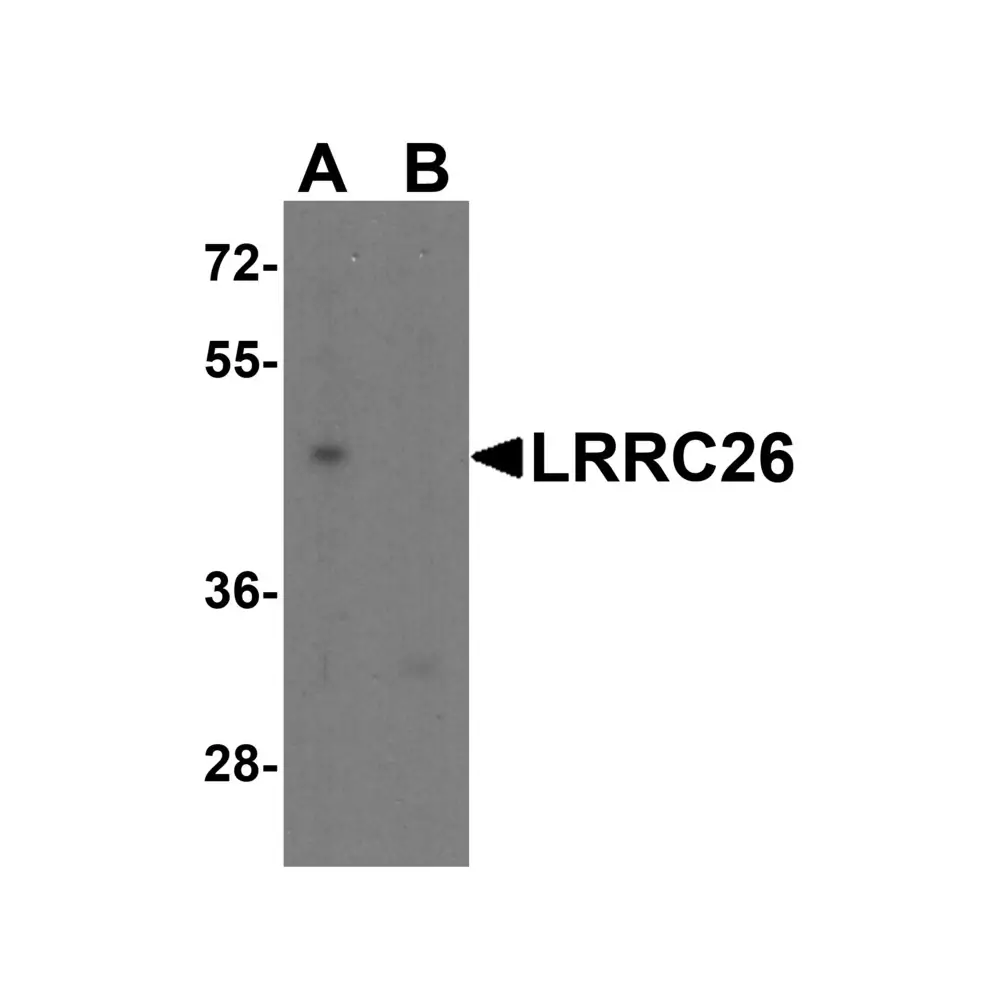 ProSci 7539 LRRC26 Antibody, ProSci, 0.1 mg/Unit Quaternary Image