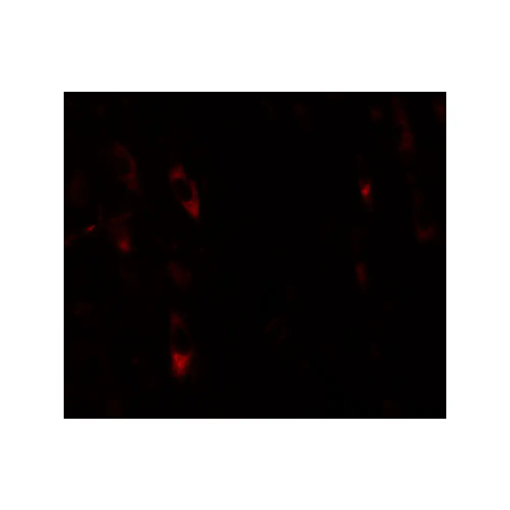 ProSci 6167 LRRTM1 Antibody, ProSci, 0.1 mg/Unit Tertiary Image