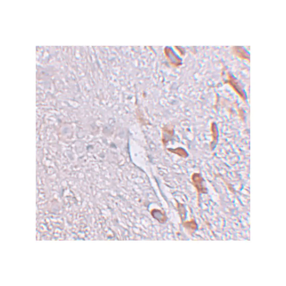 ProSci 6167_S LRRTM1 Antibody, ProSci, 0.02 mg/Unit Secondary Image