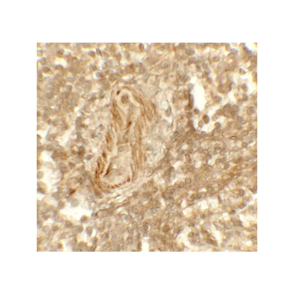 ProSci 8223 LSD1 Antibody, ProSci, 0.1 mg/Unit Tertiary Image