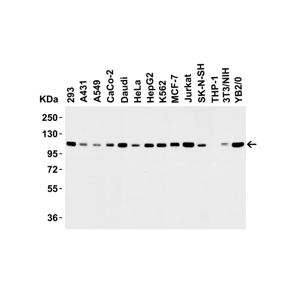 ProSci 3761_S LSD1 Antibody, ProSci, 0.02 mg/Unit Primary Image