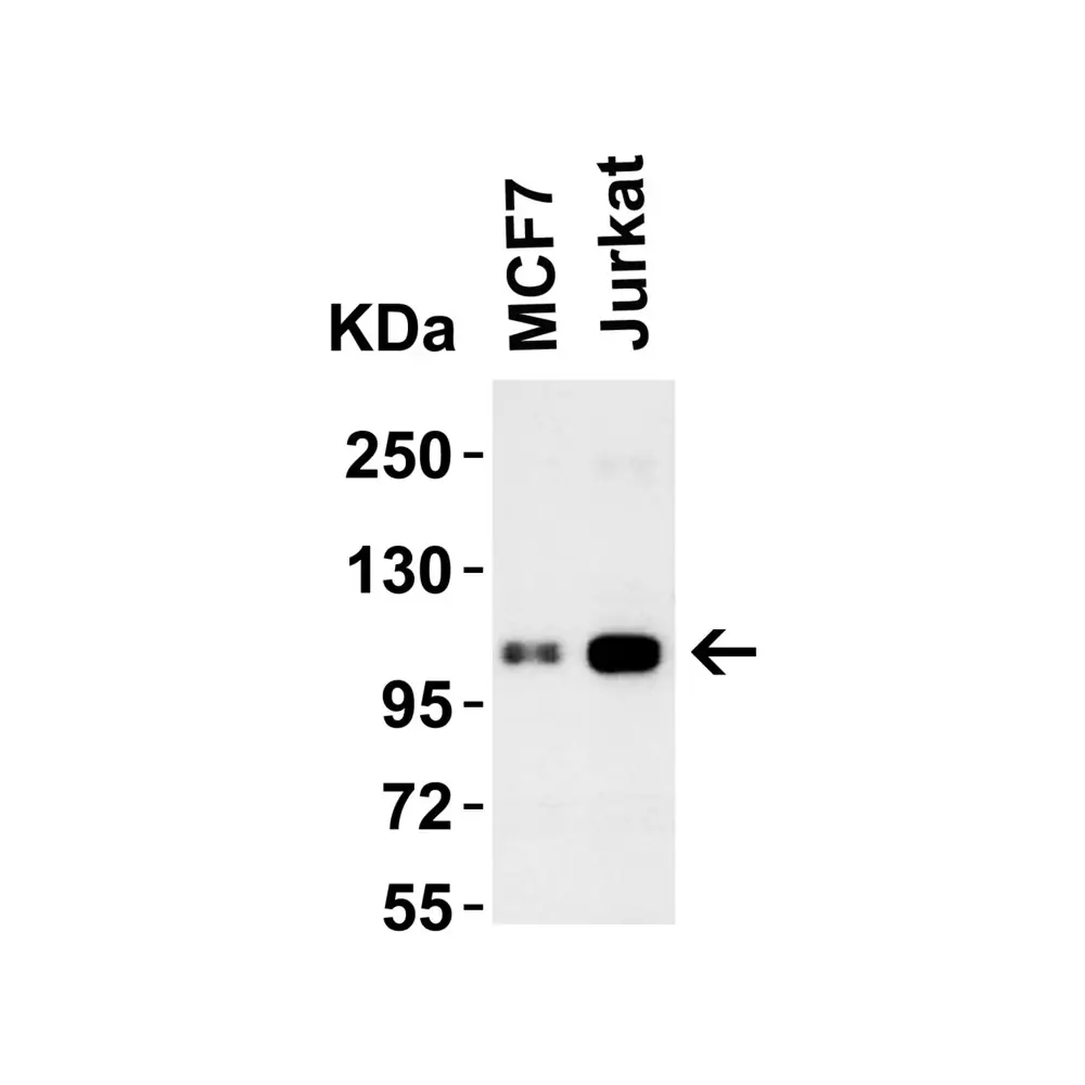 ProSci 3763_S LSD1 Antibody, ProSci, 0.02 mg/Unit Primary Image