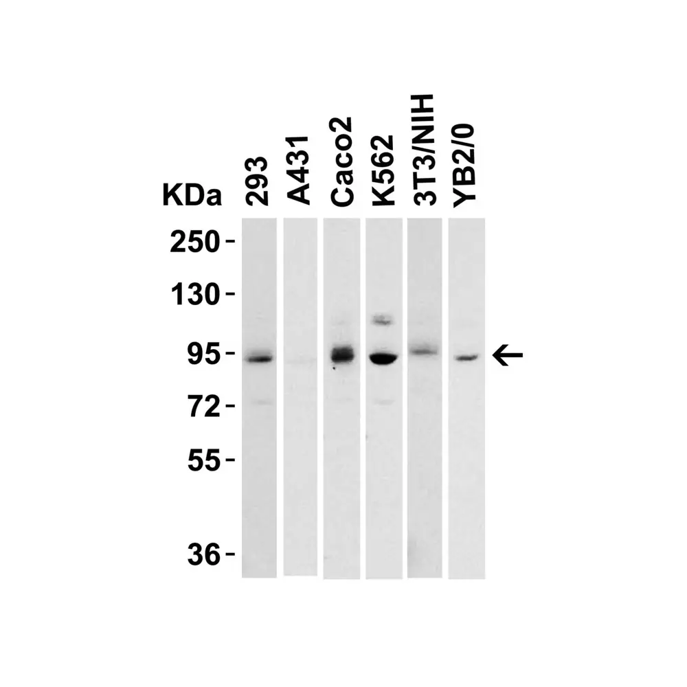 ProSci 8223_S LSD1 Antibody, ProSci, 0.02 mg/Unit Primary Image