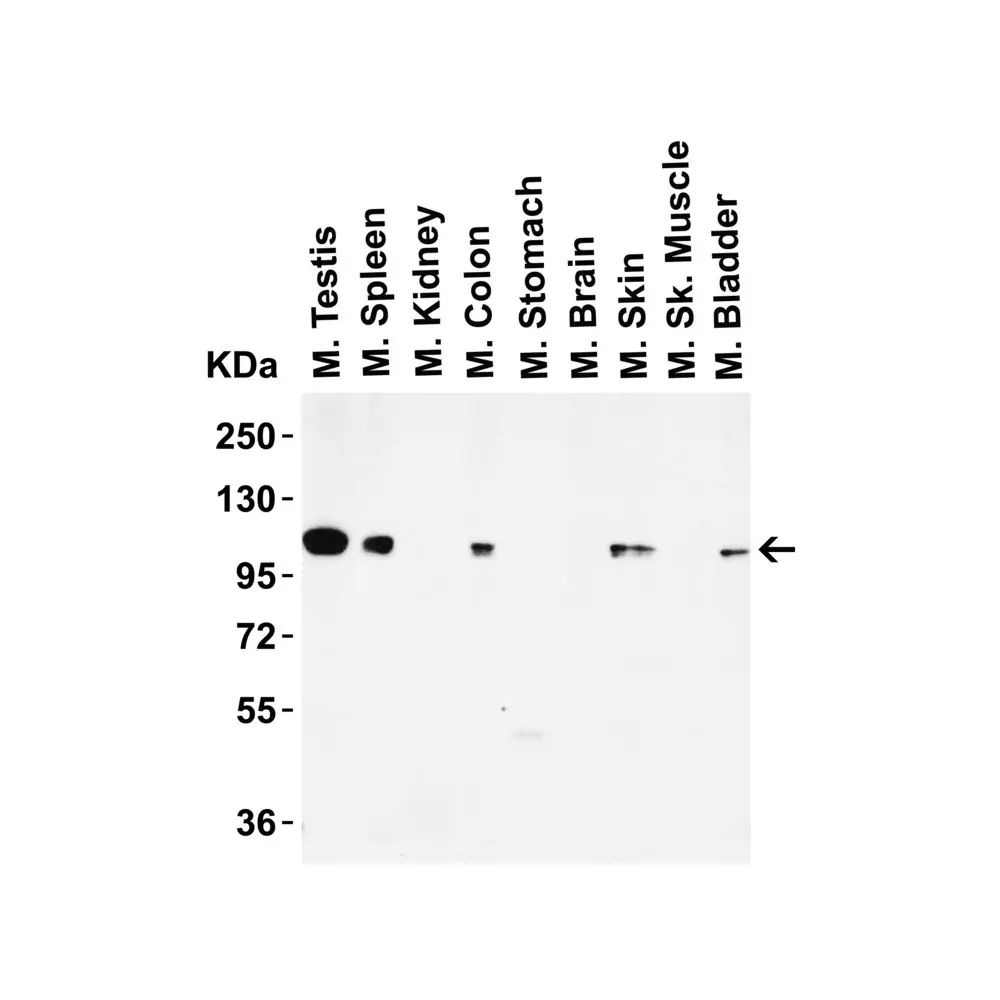 ProSci 3761_S LSD1 Antibody, ProSci, 0.02 mg/Unit Tertiary Image