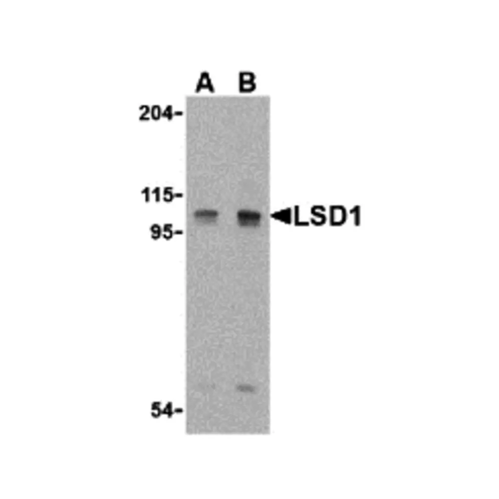 ProSci 3763_S LSD1 Antibody, ProSci, 0.02 mg/Unit Tertiary Image