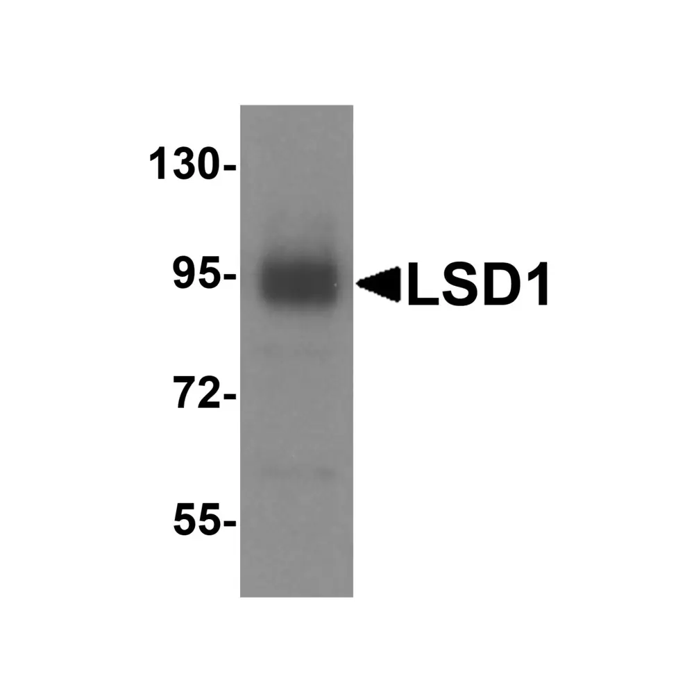 ProSci 8223 LSD1 Antibody, ProSci, 0.1 mg/Unit Secondary Image