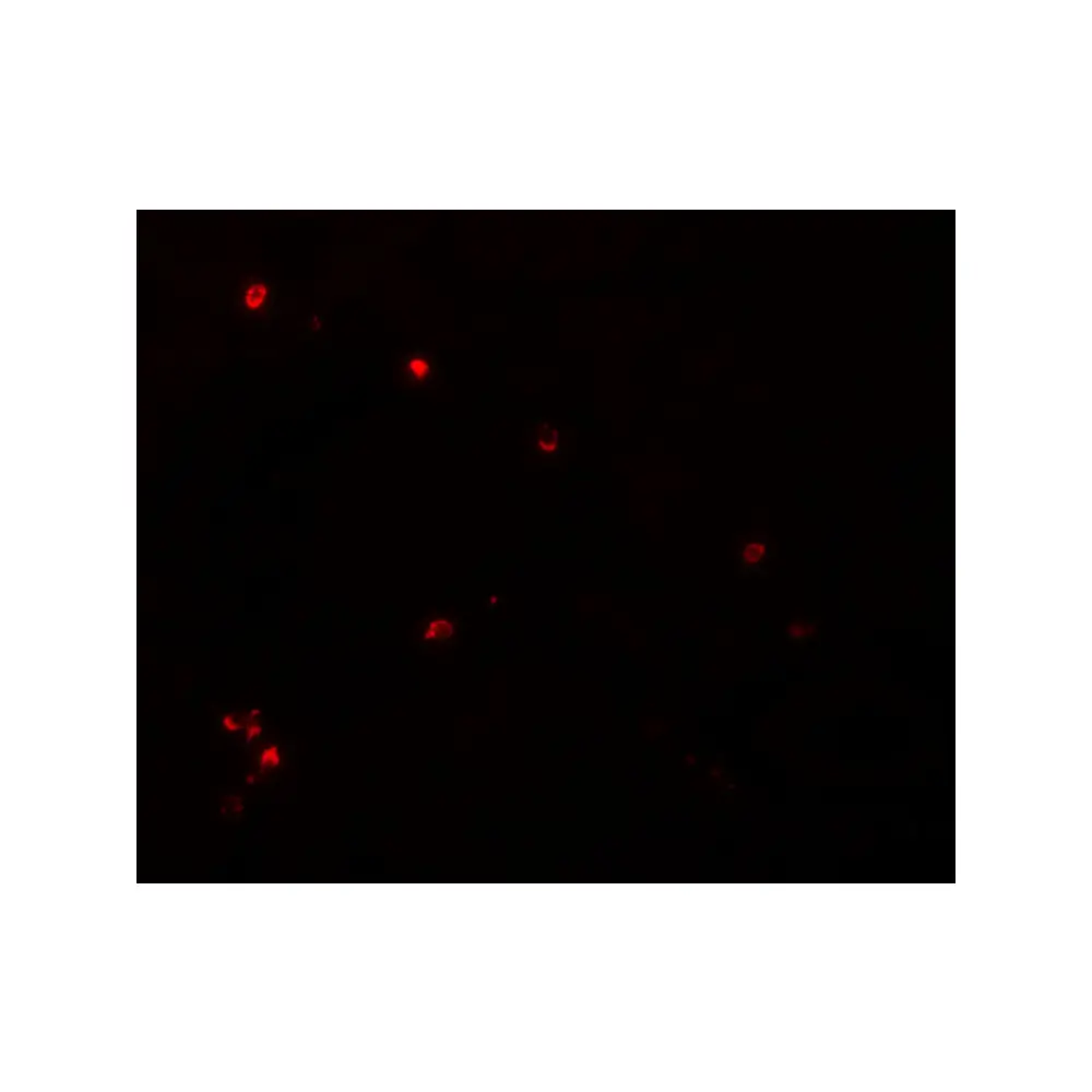 ProSci 5663_S LYRM3 Antibody, ProSci, 0.02 mg/Unit Tertiary Image