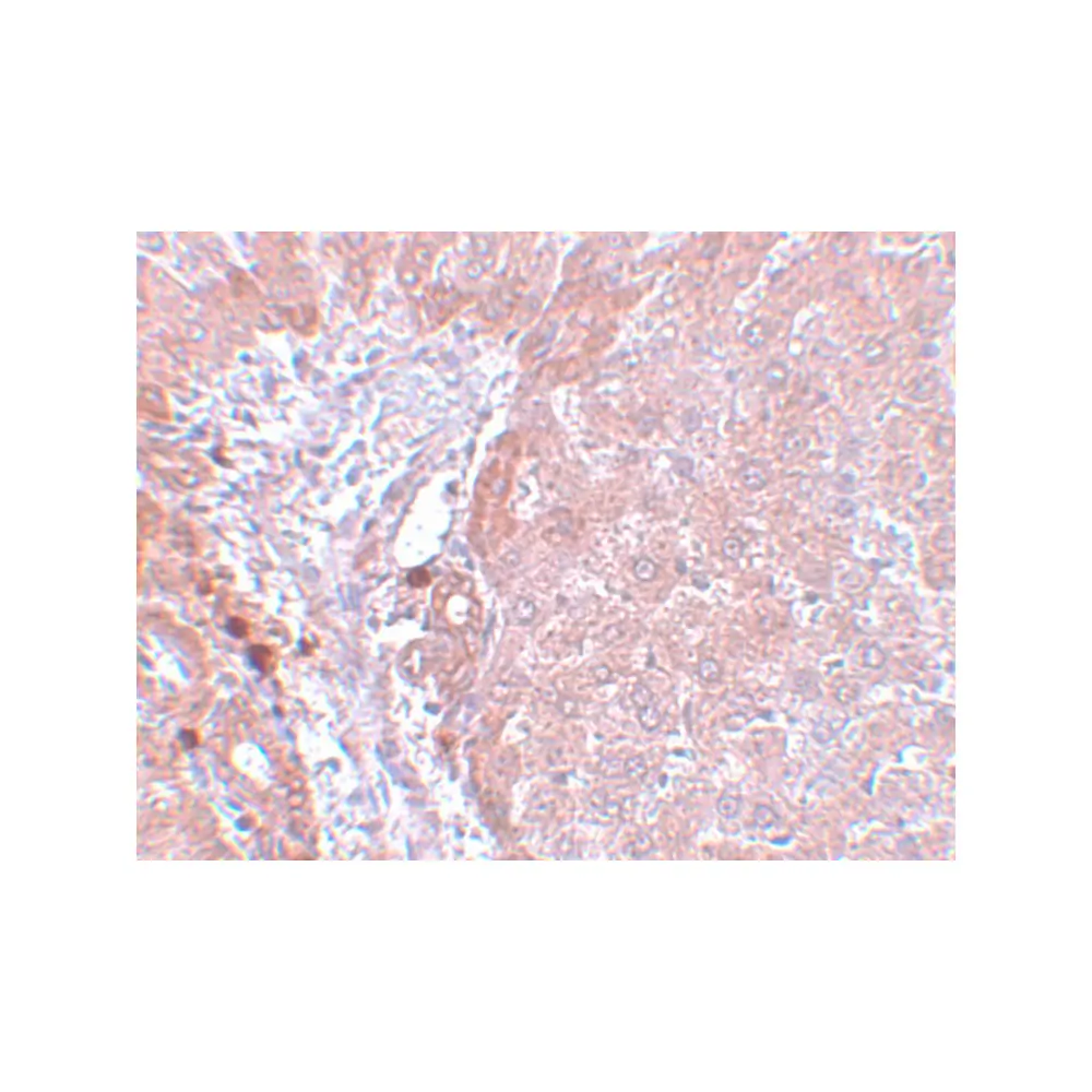 ProSci 5663_S LYRM3 Antibody, ProSci, 0.02 mg/Unit Secondary Image