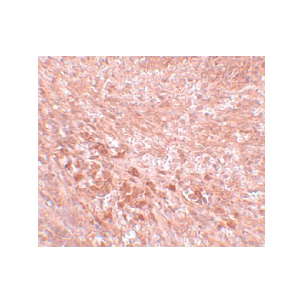 ProSci 5623_S LZTR2 Antibody, ProSci, 0.02 mg/Unit Secondary Image