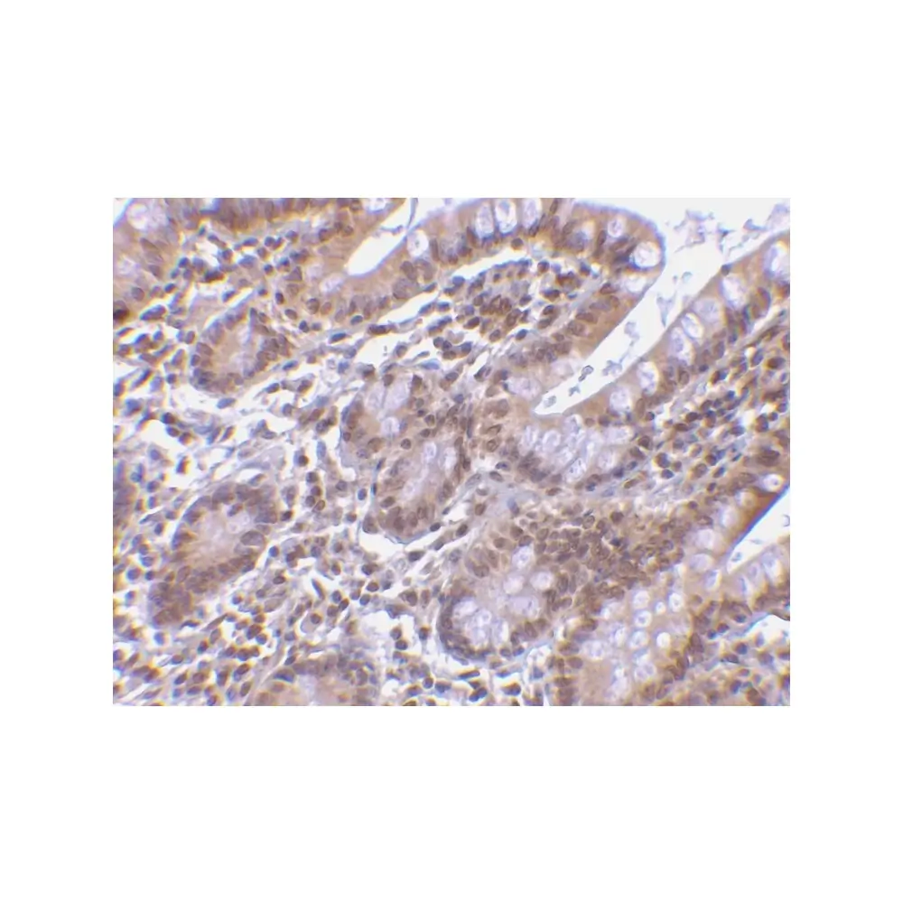 ProSci 2505_S Livin Antibody, ProSci, 0.02 mg/Unit Secondary Image