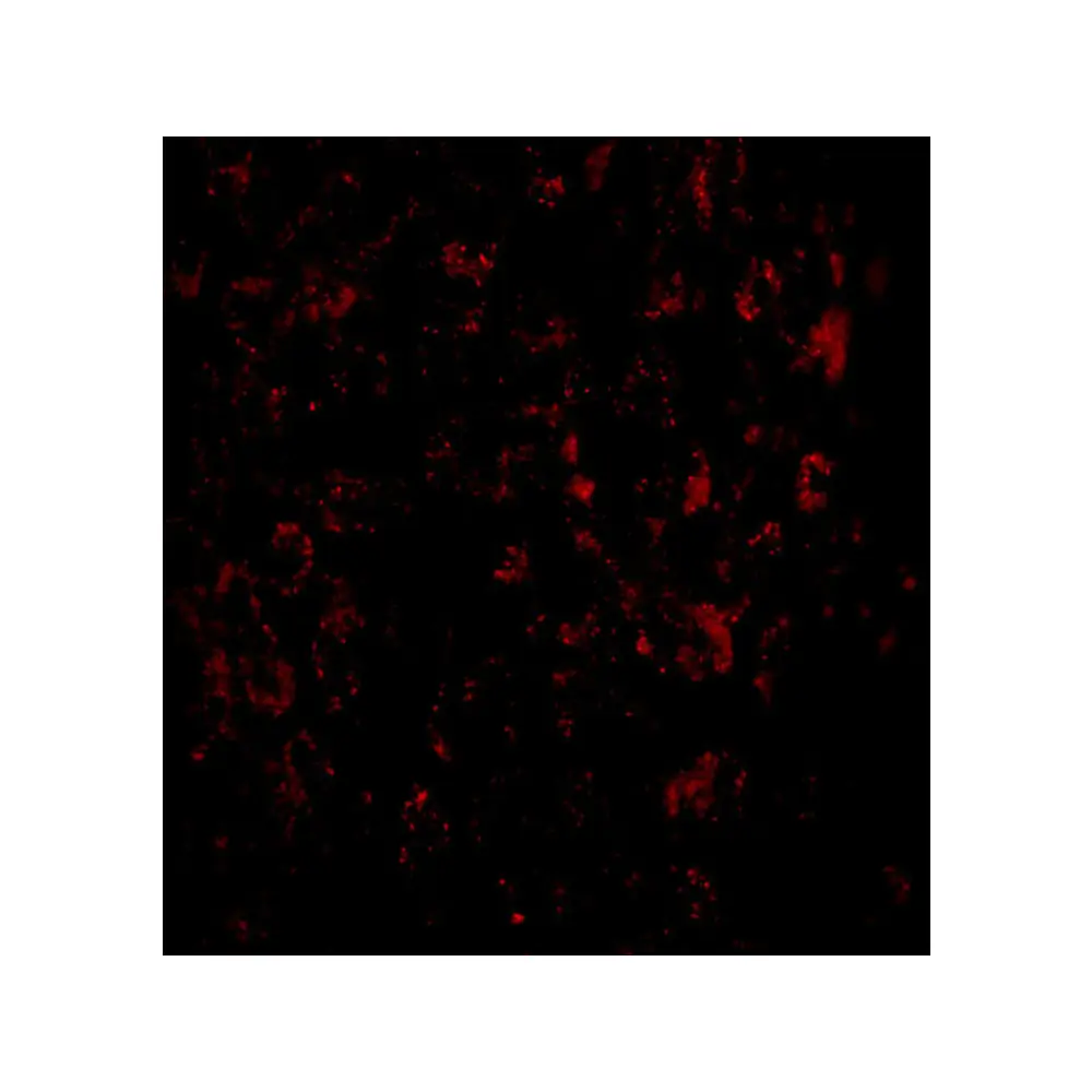 ProSci 5197 MACC1 Antibody, ProSci, 0.1 mg/Unit Tertiary Image