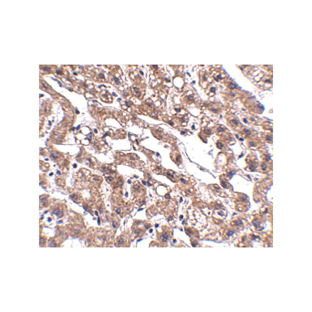 ProSci 5197_S MACC1 Antibody, ProSci, 0.02 mg/Unit Secondary Image