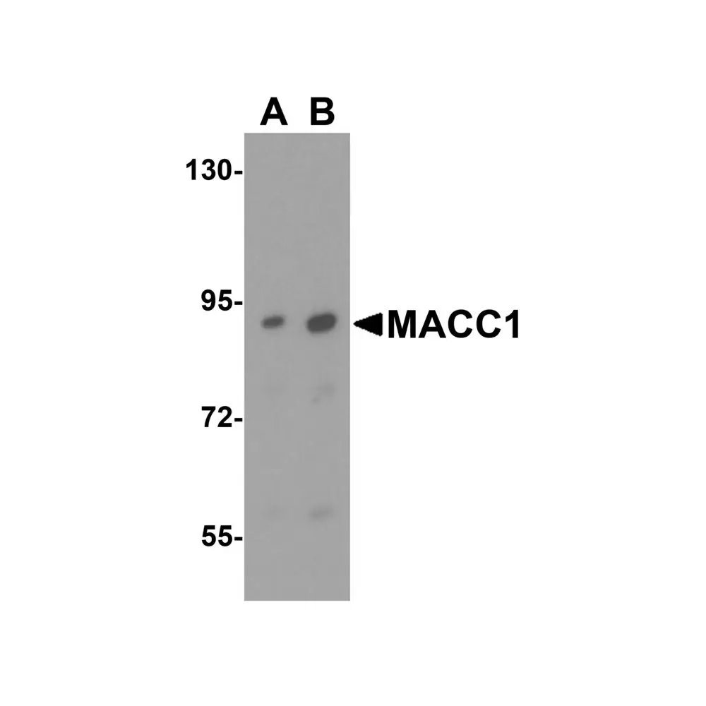 ProSci 5197_S MACC1 Antibody, ProSci, 0.02 mg/Unit Quaternary Image
