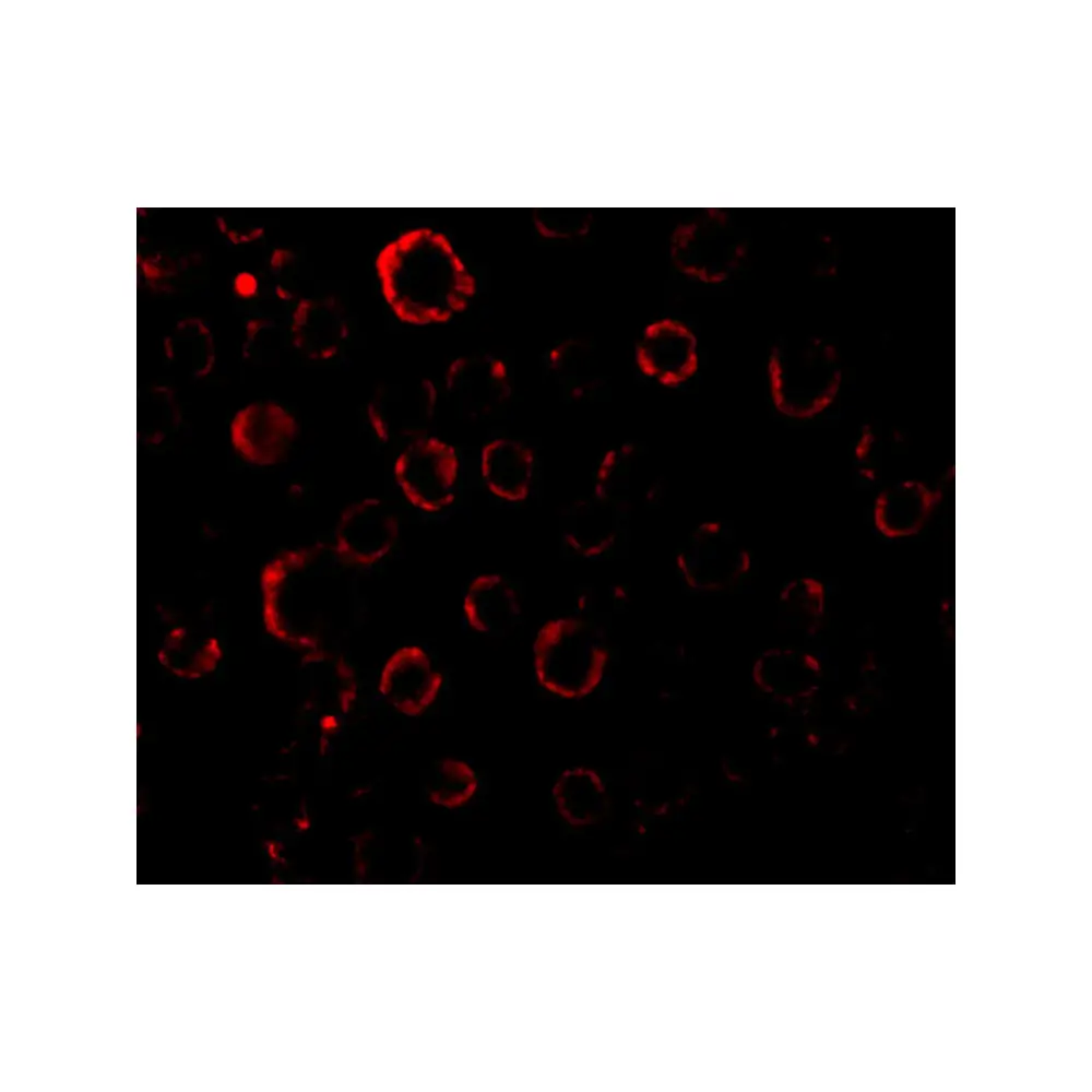 ProSci 1150 MADD Antibody, ProSci, 0.1 mg/Unit Tertiary Image