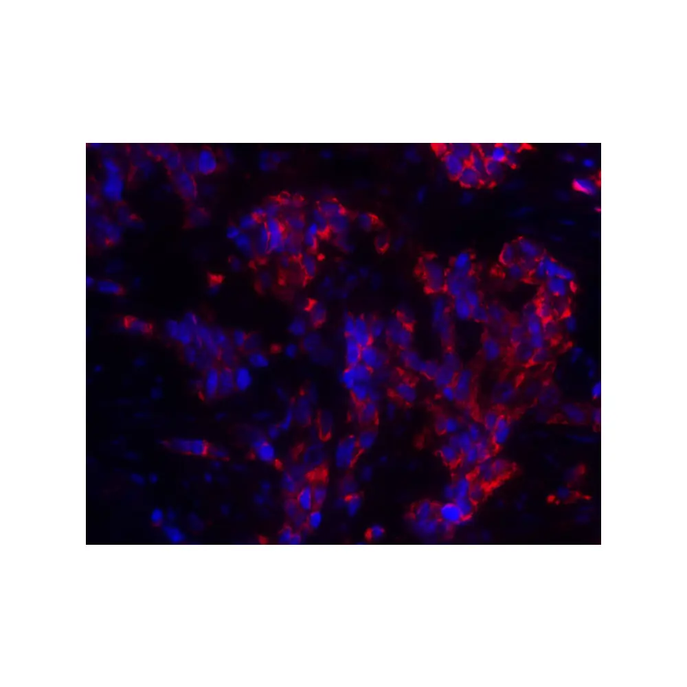 ProSci 8191_S MAGEA4 Antibody, ProSci, 0.02 mg/Unit Quaternary Image
