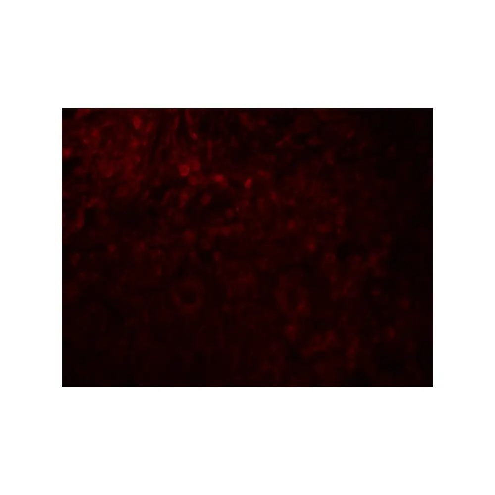 ProSci 8191_S MAGEA4 Antibody, ProSci, 0.02 mg/Unit Tertiary Image