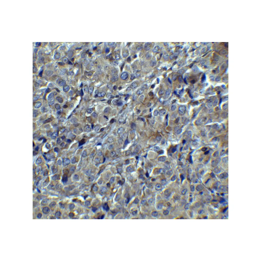 ProSci 8191_S MAGEA4 Antibody, ProSci, 0.02 mg/Unit Secondary Image
