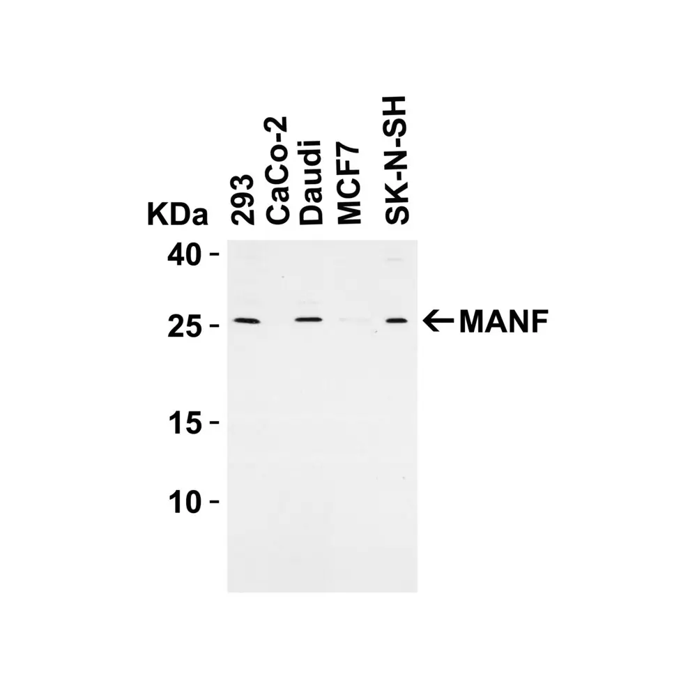 ProSci 4349 MANF Antibody, ProSci, 0.1 mg/Unit Primary Image
