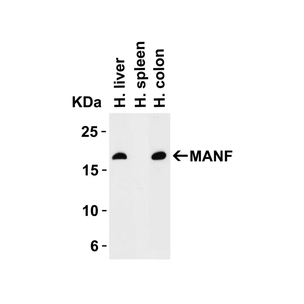 ProSci 4347_S MANF Antibody, ProSci, 0.02 mg/Unit Quaternary Image